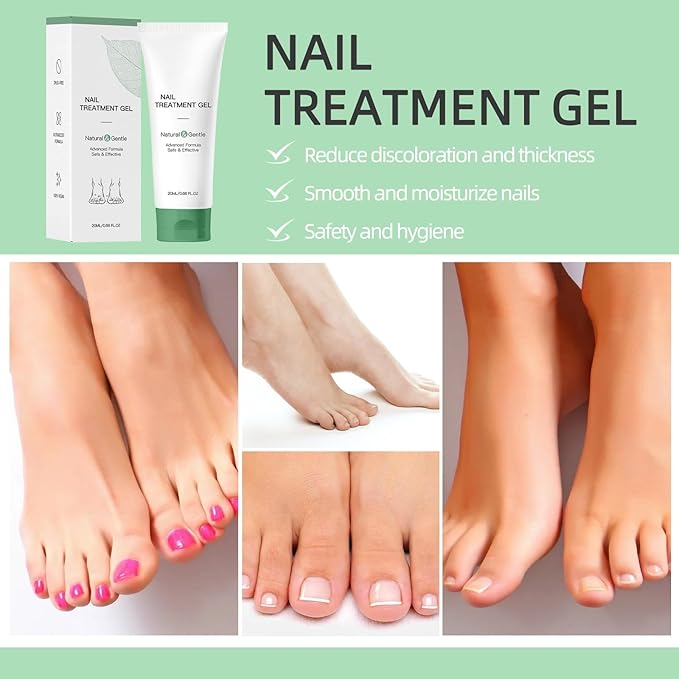 2Pcs Nail Fungus Treatment Gel, Natural Nail Care Gel, Multi-Purpose Nail Repair Oil Serum.