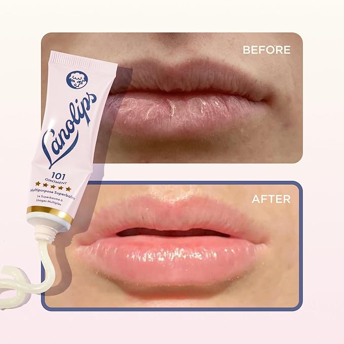 Lanolips 101 Ointment - Lanolin Lip Balm for Smooth, Hydrated & Healthy Lips - Multipurpose Lip Ointment with Lanolin Oil for Dry Lips, Cuticles & More - Original Superbalm (0.52 oz)