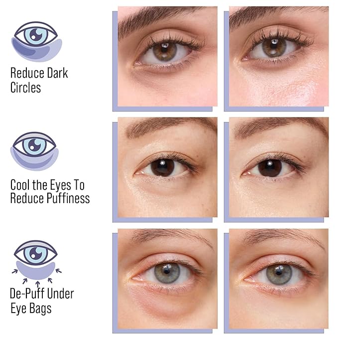 Ultimate Duo-pack Under Eye Patches 28 Pairs, 5-Min Revive Hydrogel Eye Masks with Caffeine Retinol Niacinamide to Reduce Dark Circles Puffiness Wrinkles, Refresh Tired Eyes, Bridesmaid Women Gifts