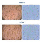 Hair Growth Serum Roll-On 30ml | Patented Blend with 3% Rosemary, 3% Redensyl, 2% AnaGain, Biotin & Niacinamide | No-Rinse, Fast-Absorbing | For Thinning Hair & All Hair Types (1.01 Fl Oz (Pack of 1))