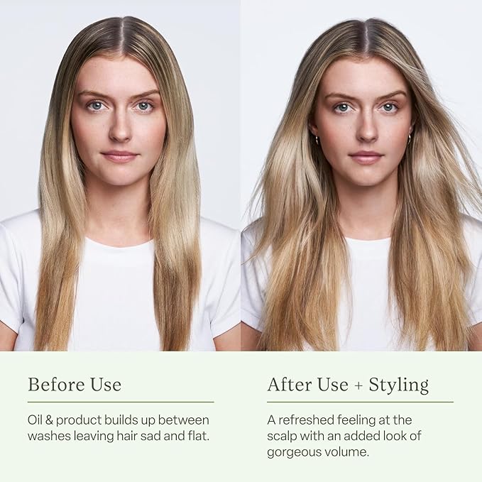 Divi Dry Shampoo Spray for Women - Formulated to Absorb Oil, Balance the Scalp and Extend Time Between Washes - Free of Benzene, Butane, Propane and Talc, 5.3oz (2 Pack)