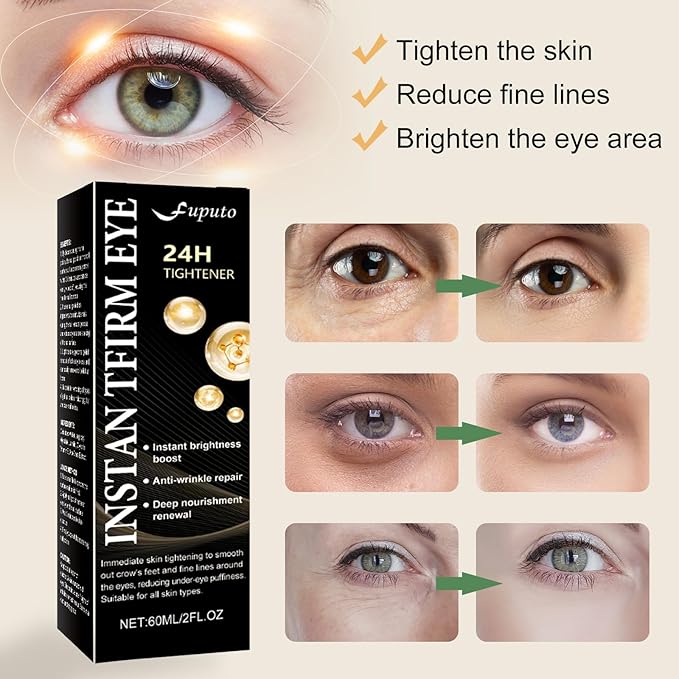 Temporary Instant Eye Tightener Cream – 60 ML Retinol Under Eye Cream Quickly Reduces Dark Circles, Targets Eye Bags, Puffiness & Lines & Firming, Deep Hydration & Moisture Lock (1Pack)