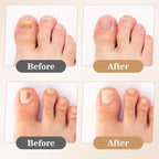 200 Pcs Nail Repair Patches, Muti-Purpose Fungus Nail Treatment Patch,Toenail Care for Toenail Fingernails,8-Hour Nighttime Renewal Toenails Fungus Patches for Damaged & Discolored Appearance Nails