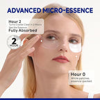 Peptide Under Eye Patches, Firming Eye Patches Instant Reduces Dark Circles and Puffiness, Collagen Under Eye Mask for Bags Treatment, Wrinkles, 12 Pairs