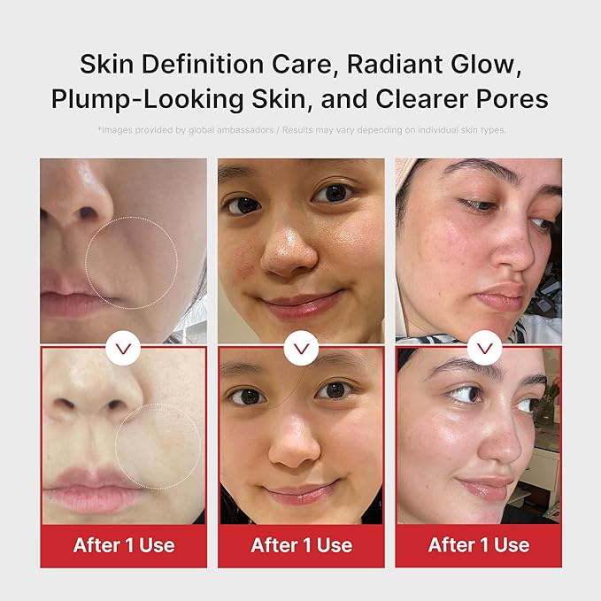 medicube Pink Skincare Set for Glass Glow Skin: Age-R Booster Pro Pink | 6-in-1 Real Glass Glow Beauty Massager and Collagen Jelly Cream- Niacinamide & Freeze-Dried Hydrolyzed Collagen 110ml