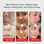 medicube Pink Skincare Set for Glass Glow Skin: Age-R Booster Pro Pink | 6-in-1 Real Glass Glow Beauty Massager and Collagen Jelly Cream- Niacinamide & Freeze-Dried Hydrolyzed Collagen 110ml