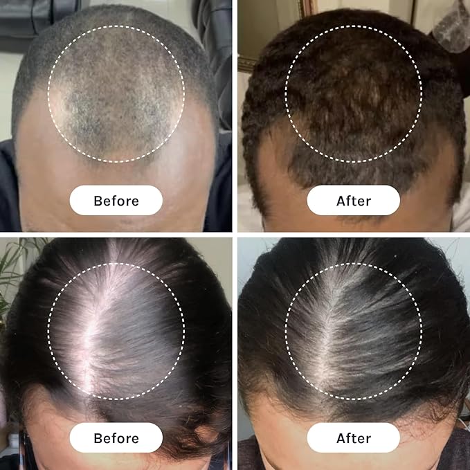 InfiniWell Duo - Scalp & Hair Serum for Hair Growth - Encourage Visible Fullness - Physician-Formulated - Nourish Follicle Health & Support the Strength & Structure of Strands (25 ml)