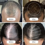 InfiniWell Duo - Scalp & Hair Serum for Hair Growth - Encourage Visible Fullness - Physician-Formulated - Nourish Follicle Health & Support the Strength & Structure of Strands (25 ml)