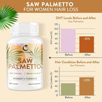 Saw Palmetto for Women Hair Loss - DHT Blocker with 5-in-1 Blend for Hair Growth, Skin & Nails, Urinary Wellness - Extra Strength Saw Palmetto Supplement - 90 Capsules