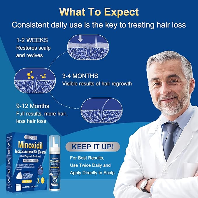 5% minoxidil foam for men-5pack， Infused with Biotin, Hair Growth Treatment, Supports Thicker and Fuller Hair & Beard (10.5oz, 5 Month Supply)