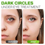 Peptide Eye Cream Anti Aging, Hydrating Under Eye Cream For Women & Men Dry, Sensitive or Mature Skin Repair, Daily Day & Night Treatment for Fine Lines, Wrinkles, Dark Circles, Bags, Puffiness 0.5 Oz