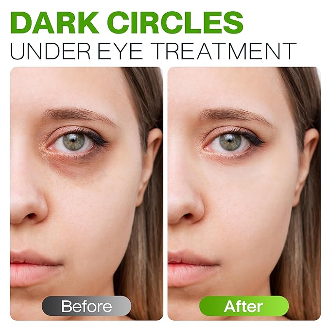 Peptide Eye Cream Anti Aging, Hydrating Under Eye Cream For Women & Men Dry, Sensitive or Mature Skin Repair, Daily Day & Night Treatment for Fine Lines, Wrinkles, Dark Circles, Bags, Puffiness 0.5 Oz