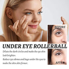 Rollerball Castor Oil And Frankincense, 10 ML Castor Oil And Frankincense Eye Roller, Castor Oil Frankincense Rollerball Under Eye, Castor Oil Roller Ball (3pcs)