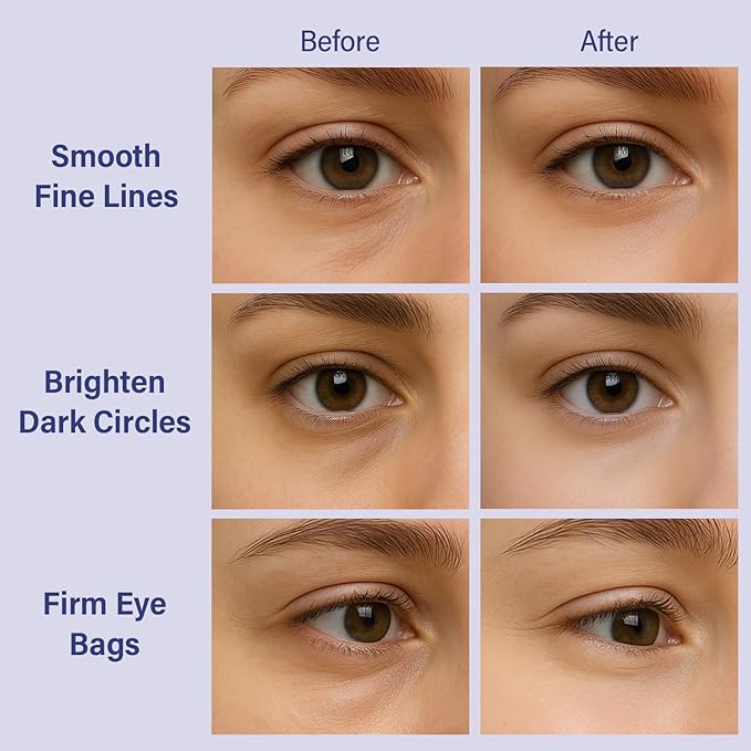 DIAMOND GAZE Firming Hydrogel Eye Patches 28 Pairs, 5-Min Retinol & Niacinamide Eye Masks to Smooth and Brighten, Reduce Fine Lines & Dark Circles, Relaxing Gifts for Her Holiday Set