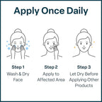 QRxLabs Salicylic & Glycolic Acid Pads (2% Salicylic & 10% Glycolic) - Acne Pads for Face & Bacne with Vitamins B5, C & E, Calendula & Green Tea - Face Exfoliator - 50 Count Jar