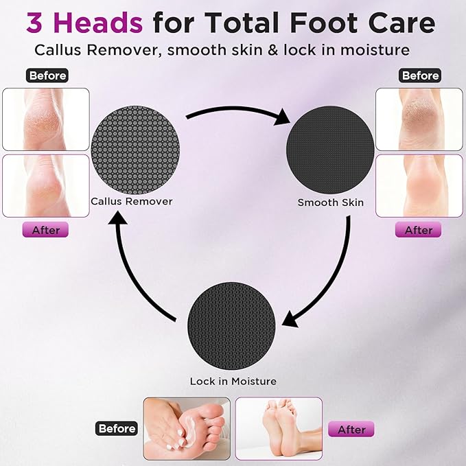 Electric Callus Remover, Apply Oil,Foot SPA,Electric Foot File,Reusable Nano-Glass Head, Ergonomic Callus Remover for feet, Rechargeable Pedicure Tools for Feet,Gifts for Men Women
