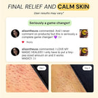 MyMagicHealer Thyme & Tea Tree Flare Care | Ingrown Hair, Razor Bumps, Blind Pimples, Bartholin, Pilonidal Cysts | Folliculitis Cure | Piercing Care w/Egg Yolk Extract & Tea Tree 4 oz