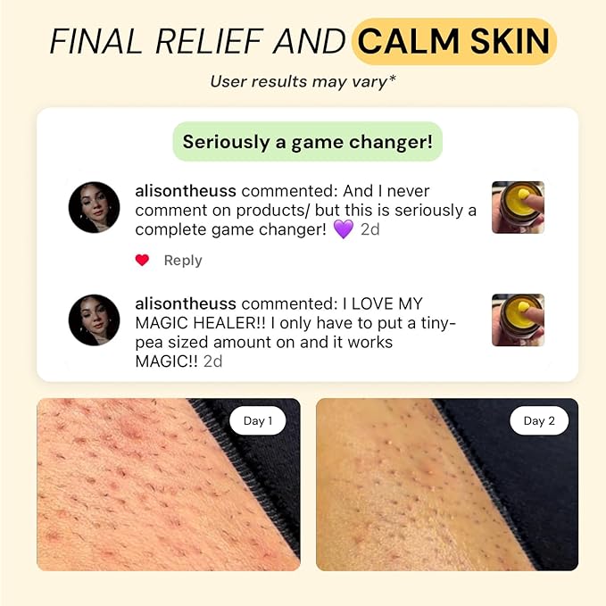 MyMagicHealer Thyme & Tea Tree Flare Care | Ingrown Hair, Razor Bumps, Cystic Acne, Blind Pimples, Bartholin, Pilonidal Cysts | Folliculitis Cure | Piercing Care w/Egg Yolk Extract & Tea Tree 2 oz