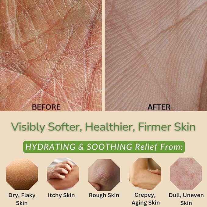 Moisturizing & Firming Lemongrass Body Lotion & Hand Cream - Natural Moisturizer for Dry Skin, Itchy or Crepey Skin - Eczema Treatment - Olive Oil, Coconut Oil & Avocado Oil - 8oz