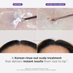 Dr. Groot Thickening Shampoo & Scalp Treatment Set for Hair Loss – Clinical Results with Biotin and Rosemary for Hair Thinning, Shedding, Scalp Repair and Treatment