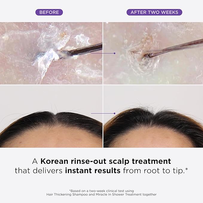 Dr. Groot Miracle in Shower Moisturizing Treatment for Hair Loss, Korean Hair Care Rinse, Rosemary Oil for Smooth, Healthier-Looking Hair in 5 Seconds, Scalp Revitalizing Solution