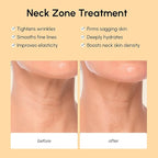 MAREE Neck Wrinkle Patches – Collagen Anti-Wrinkle Patches with Retinol & Hyaluronic Acid for Face Lift – Neck Mask for Tightening and Firming – Neck Lifting Mask & Face Tape for Neck Wrinkles – 5 Pcs