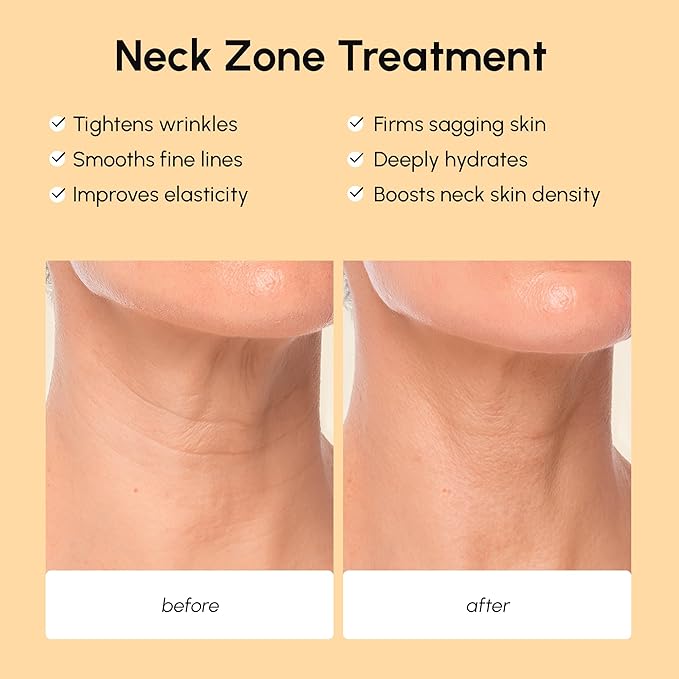 MAREE Neck Wrinkle Patches – Collagen Anti-Wrinkle Patches with Retinol & Hyaluronic Acid for Face Lift – Neck Mask for Tightening and Firming – Neck Lifting Mask & Face Tape for Neck Wrinkles – 5 Pcs