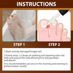 2PCS Paronychia Nursing Oil, German Toenailcare Anti Paronychia Relief Oil, Repair for Damaged Discolored Thick Nails