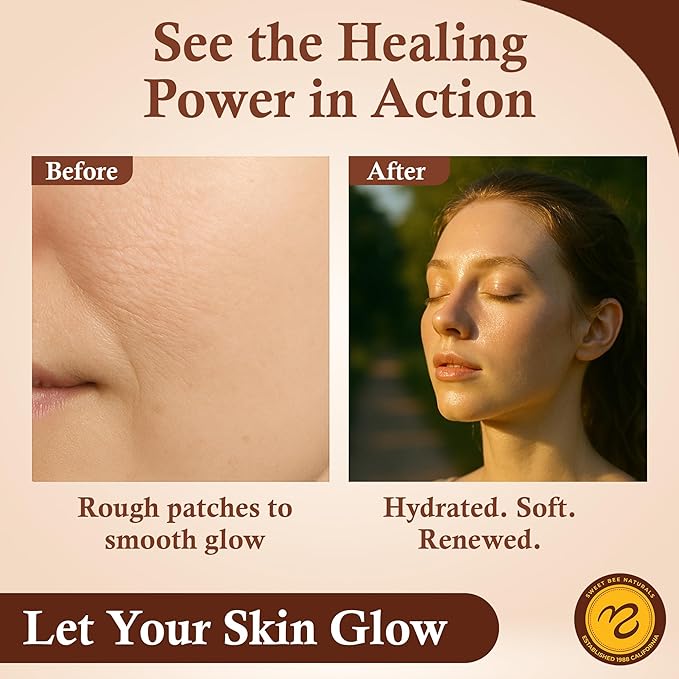 Sweet Bee Naturals - Sweet Bee Magic, All In One Healing Organic Balm. Organic Skin Aid, Small Batch Crafted in USA, Certified Organic, All Natural Skin Aid- 2 Ounce Jar