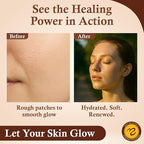 Sweet Bee Naturals - Sweet Bee Magic, All In One Healing Skin Cream. Organic Skin Balm, Small Batch Crafted in USA, 4 Ounce Jar. Certified Organic, 2-4 Ounce Jars (8 Ounce)