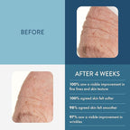 Lancer Skin Care - The Method: Sensitive-Dehydrated Set