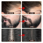 VOLLUCK Root Touch up Powder, Instant Hairline Powder for Thinning Areas and Gray Hair Coverage, Natural and Non-greasy Root Cover up for Women and Men (Black, 0.35 Ounce)