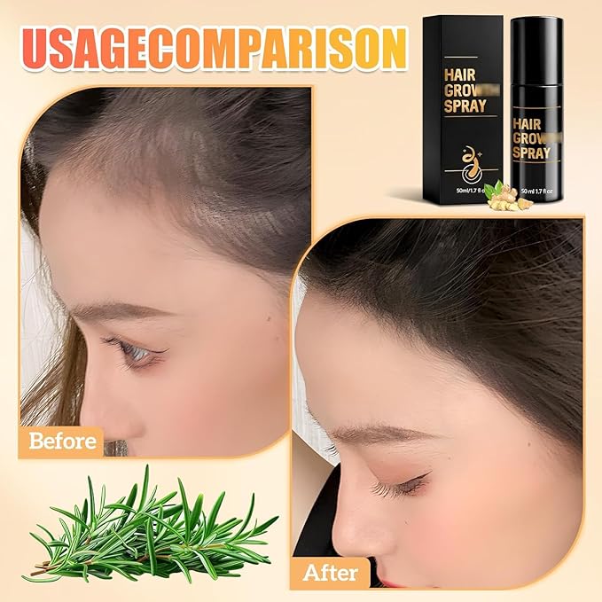 Hair Growth Spray, Hair Growth, HairGrow Oil Spray, Promotes Thicker Fuller Hair –All Hair Types with Natural Ingredients, Reduced Shedding, Hydration and Silky Texture- 50ml