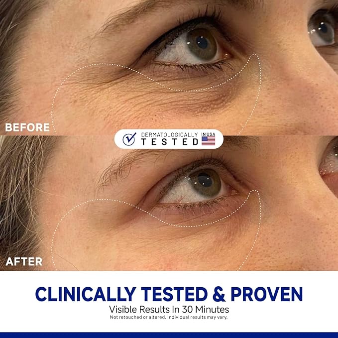 Peptide Jojoba Under Eye Patches, Firming Eye Patches Instant Reduces Dark Circles and Puffiness, Collagen Under Eye Mask for Bags Treatment, Wrinkles, 60 Pcs for Women