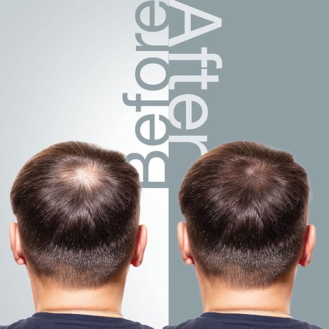 The Mossi London Hair Growth Shampoo for Thinning and All Hair Types - 6.7 Fl Oz (200ml)