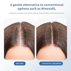 Hair Growth Serum Roll-On 30ml | Patented Blend with 3% Rosemary, 3% Redensyl, 2% AnaGain, Biotin & Niacinamide | No-Rinse, Fast-Absorbing | For Thinning Hair & All Hair Types (1.01 Fl Oz (Pack of 1))