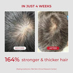 MOEV ANNURCATIN Shampoo and Conditioner Set for Men and Women, Korean Biotin Hair Growth Volumizing Shampoo, Paraben-Free Natural Apple Wash-Off Hair Mask, Rose Thickening for Damaged Hair