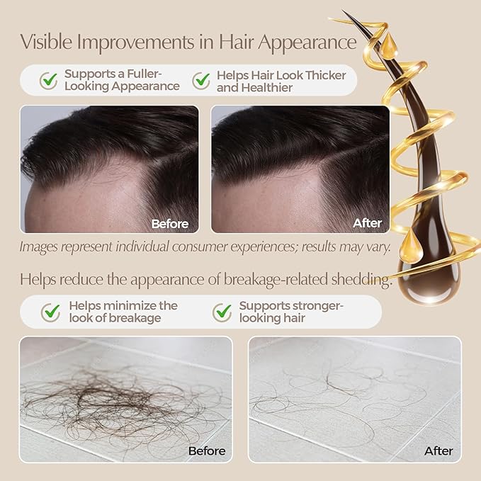 Oleuma™ TrichoGenesis Complex – Pharmacist-Formulated Bioactive Scalp & Follicle Pre-Wash Oil with Pumpkin Seed, Rosemary, Bhringraj, Black Cumin, Jojoba, Saw Palmetto, Peppermint & Vitamin E (50 mL)