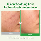 TOSOWOONG Madagascar Centella Cream, 706,580ppm Madagascar Centella Asiatica, Moisturizer, Rapid Soothing, Deep Hydration with Cica Complex, Skin Barrier Repair, Irritation Relief, 50ml / 1.69 fl. oz.