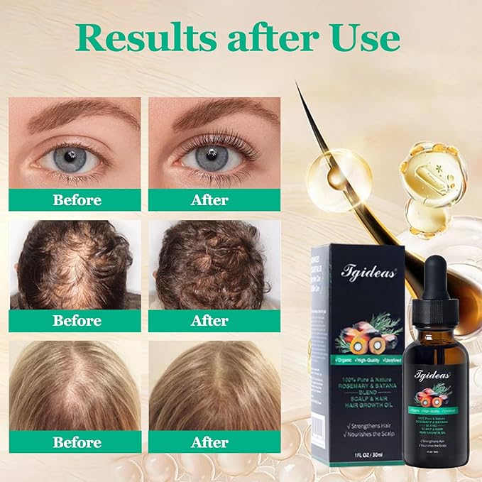 Tgideas Rosemary Batana Oil - Organic Hair Growth - for Scalp & Hair Strengthening - All Hair Types Treatment Oil - Eyebrow & Eyelash Nourishing - 2 Packs
