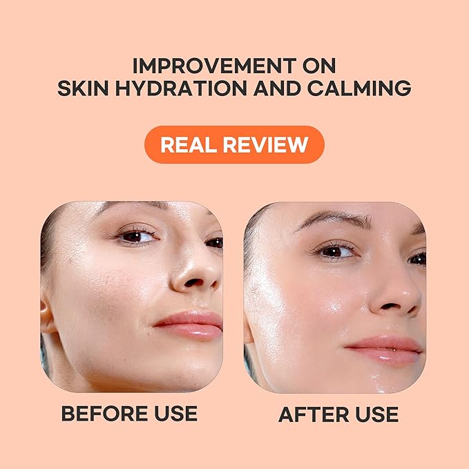 Epielle Vitamin C Serum Sheet Masks (5pk) | Korean Skincare | Facial Sheet Mask | Kbeauty, Spa Gifts for Women