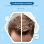 Tricovit Forte Hair Loss Treatment - Hair Growth Products for Women & Men Developed by Dermatologists - DHT Blocker & Sebum Regulator for Strengthening Follicles & Balancing Scalp (10 Ampoules)