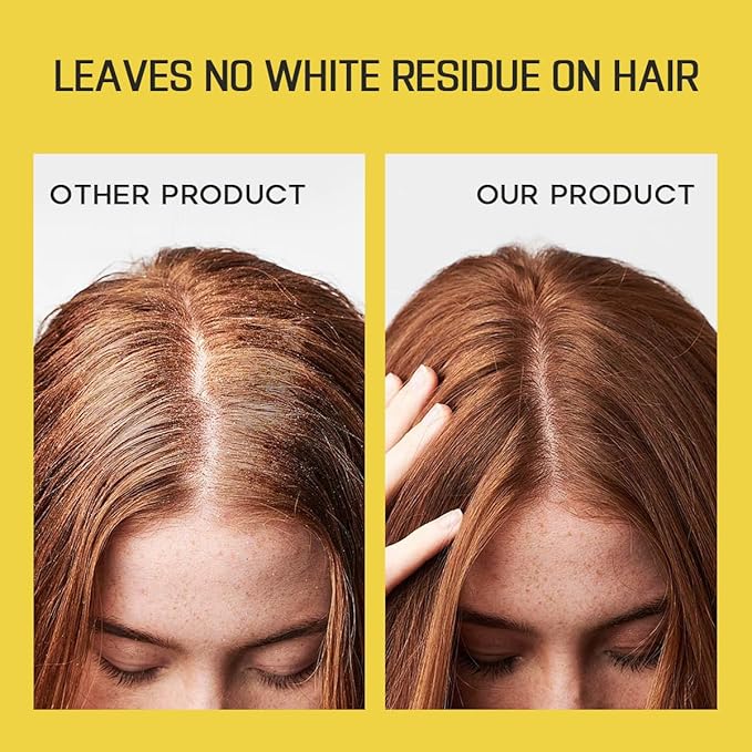 HALOVIDA Dry Shampoo for Women, Dry Scalp Shampoo Spray for Dark Hair Leaves No White Residue, Absorb Oils, Volumizing & Refresh Hair for 72 Hours, 5.07 Fl Oz((Pack of 2)