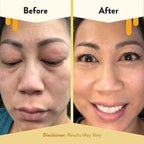 ECZEMA HONEY Soothing Facial Cream - Eczema Lotion for Face, Eyelids, Lips, and More - Natural Dry Skin Repair (2 Oz)