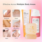 Butt Acne Clearing Set: Butt Acne Lotion + Acne Soap + Body Acne Scrub for Breakouts on Butt, Thighs, Back & Chest, KP Bumps, Clogged Pores & Rough Buttocks – Exfoliate, Cleanse & Smooth