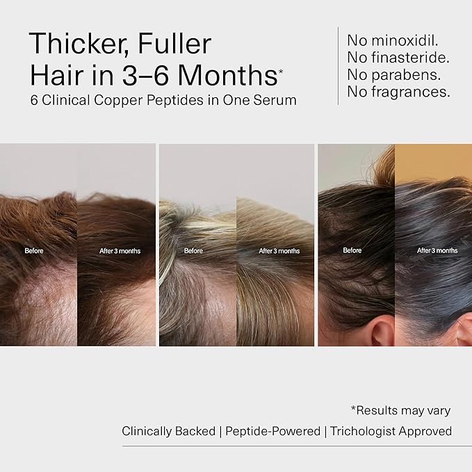 Bloom Clinically Proven Copper Peptide Hair Serum for Hair Growth - Non-Greasy & Lightweight Advanced Multi-Peptides for Women w/Thinning Hair - Made in USA - 3-Pack for 3 Months Supply