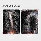 0.9% KX-826 KINTOR Hair Growth Products Foam, DHT Blocker for Men & Women Hair Regrowth, 300ml Pro