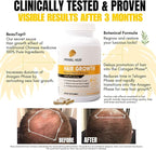 100% Natural Growth Treatment, Reduces Hair Loss, US Patented Formula Proven Effective for Men & Women, 100% Vegan Ingredients, Non-GMO, 30-Day Supply