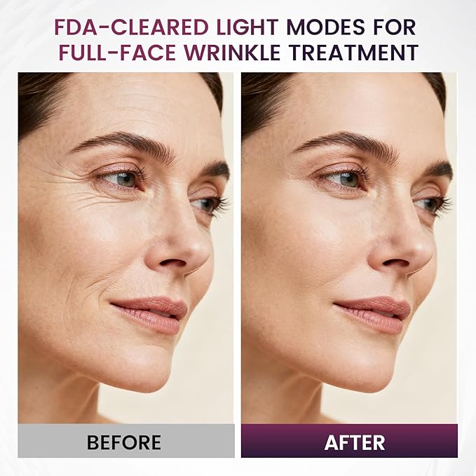 Red Light Therapy for Face – 8 Light Modes with 850nm Near-Infrared, 280 LED Face Mask Light Therapy for Skin Appearance, Fine Lines, Firming Support, FDA Cleared, Cordless Design