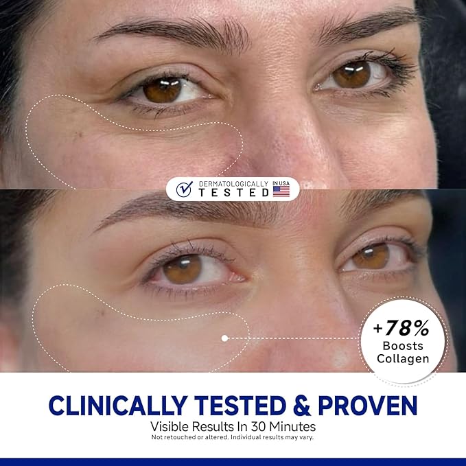 Peptide Under Eye Patches, Firming Eye Patches Instant Reduces Dark Circles and Puffiness, Collagen Under Eye Mask for Bags Treatment, Wrinkles, 24 Pairs